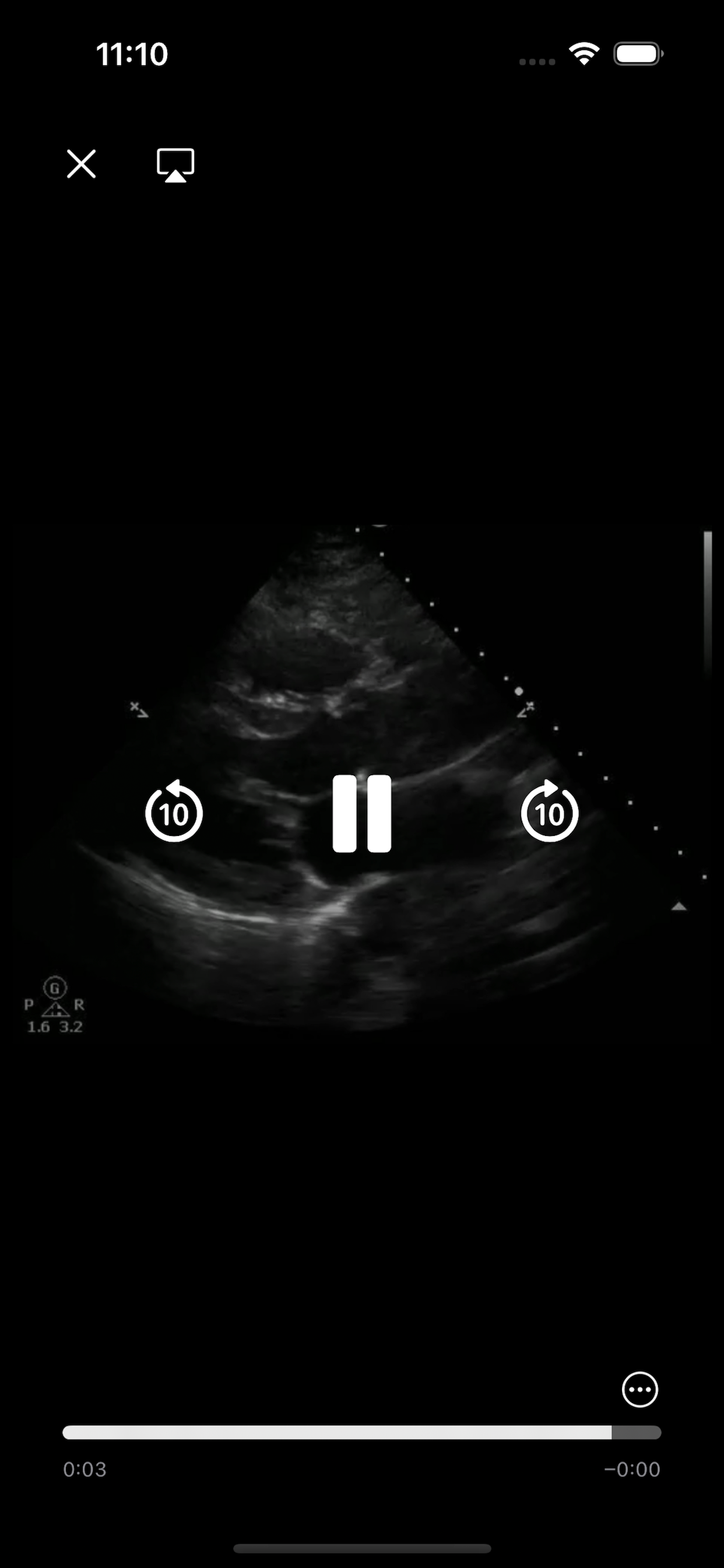 Full-screen ultrasound cine clip player with scrubber and replay controls